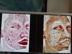-苑苑vbeauty科技美容SPA