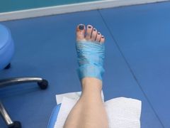 -Andrew指甲专科灰指甲·甲沟炎矫正·3D步态矫形鞋垫定制(浦三路店)