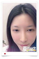 -大麦微针植发全国连锁