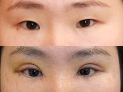 -Yestar 嘉兴艺星医疗美容医院