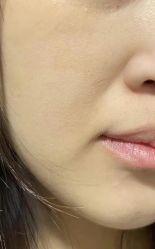 -维秘形体医美 M·VVON医生集团