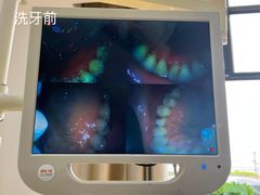 -赫尔森口腔·牙齿种植修复