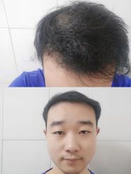 -雍禾植发全国连锁