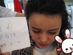 点击看大图 -大麦微针植发丨全国连锁