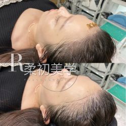 -RC半永久纹眉纹发际线