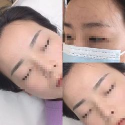 点击看大图 -久匠半永久纹眉