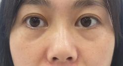 -深圳鹏爱秀琪医疗美容医院