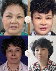 -加减美医美连锁品牌
