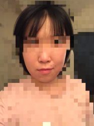 -八大处整形