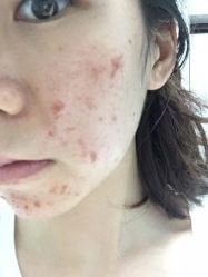 -SKINIST丽铂医疗美容
