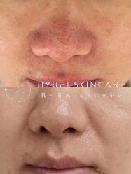 点击看大图 -MLP美丽派·问题肌疗愈中心