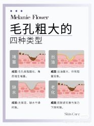 点击看大图 -玛莲朵·海菲秀冰珀科