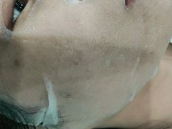 -深圳阳光医疗美容医院·旗舰店
