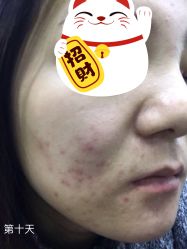 点击看大图 -禾美嘉医疗美容