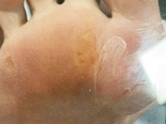 -郑远元专业修脚房(潘水路店)
