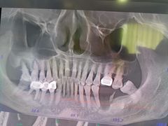 -同步齿科·数字化正畸种植口腔中心(珠海店)