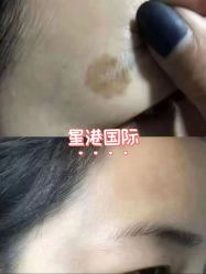 -星港国际·Skin皮肤专研·皮肤管理
