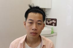 点击看大图 -大麦微针植发丨全国连锁
