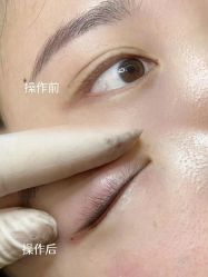 -张小野·专业半永久纹眉