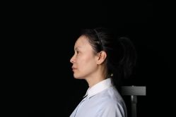 -北京叶子整形美容医院