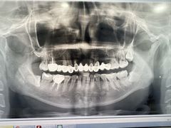-同步齿科·数字化正畸种植口腔中心(前山店)