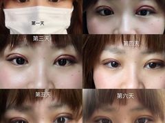 体验后-上海华安整形外科门诊部