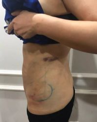 -洁铭新加坡医美
