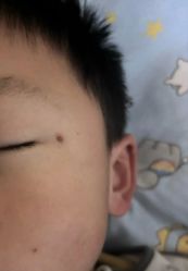 -海涛医疗美容·面部抗衰·注射美鼻