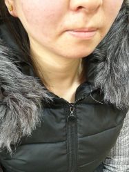 -北京美痣堂古方祛痣斑疣瘊