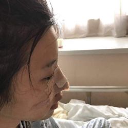 -万州华美紫馨整形美容医院
