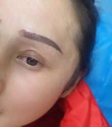 点击看大图 体验后-重庆联合丽格第五医疗美容医院