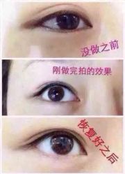 点击看大图 -悦妍韩式半永久纹眉纹绣