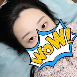 点击看大图 -郡艺医疗美容·微整·眼鼻吸脂