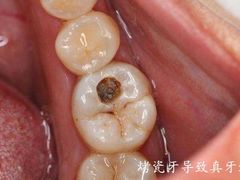 -团圆口腔·种植中心(锦江院区)