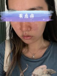 点击看大图 体验后-上海首尔丽格医疗美容医院