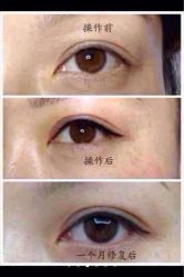 iphone_upload_pic-百秀名媛纹绣美学护肤中心