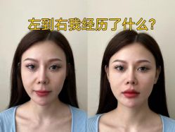 -Yestar艺星医疗美容医院