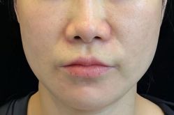 -天津健丽·去眼袋医疗美容机构