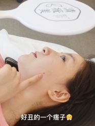-清疣美疣·痣·斑净肤中心