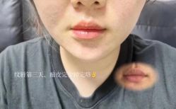 -西施无菌半永久纹绣眉眼影唇轻增发纹发际线