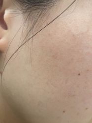 -美瑞莎创美医疗美容
