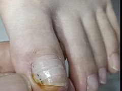 -新甲连锁灰指甲·甲沟炎·鸡眼(黑龙江路店)