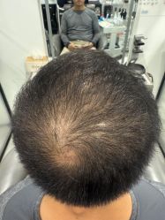 -熙朵美学植发·连锁品牌