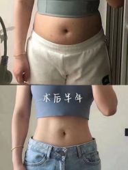 体验后-洁铭新加坡医美