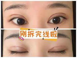 -素美医疗美容·西南眼鼻整形·修复基地