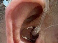 -耳朵树助听器人工耳蜗中心