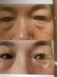 -苑苑vbeauty科技美容SPA