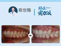 -柏乐口腔(南宁总院)