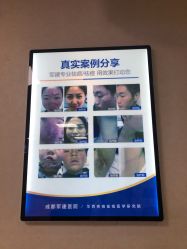 -成都军建医院·疤痕诊疗中心