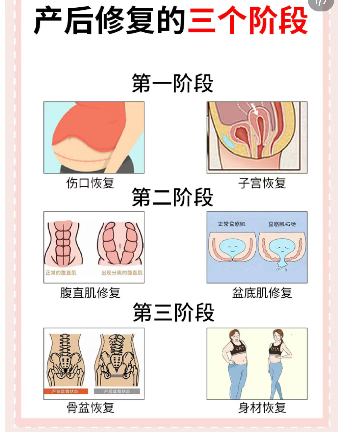 产后宫腔分离图片